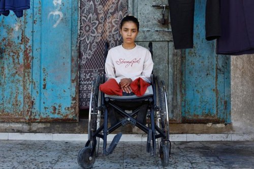 Anak-Anak Gaza Kehilangan Kaki Akibat Serangan Israel