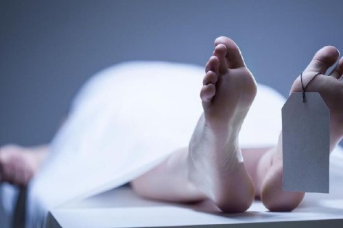 Prancis Catat Kematian Pertama Akibat Virus Shamonda, Pasien Alami Imunodefisiensi Berat