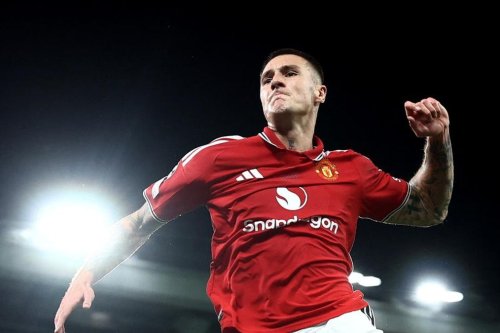 Cedera Tulang Kering Memburuk, Manchester United Kehilangan Sesko Lebih Lama hingga Januari
